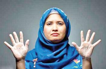 La manos de Julia, dañadas por el agua.