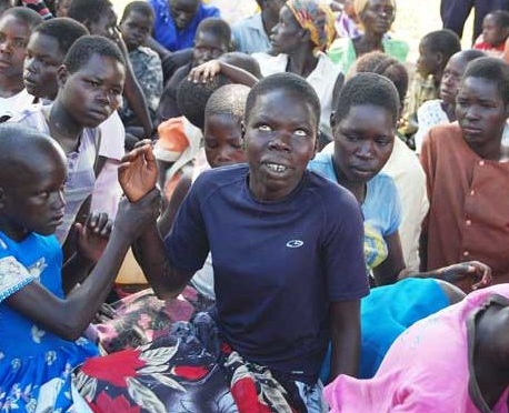 Niños de África se convierten en zombies por rara enfermedad