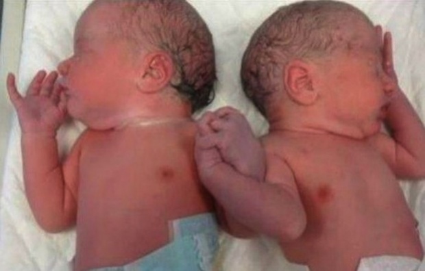 Usuarios se conmueven con imagen de mellizas tomándose de la mano al nacer