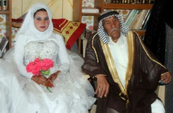 90 y 20