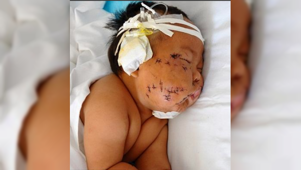 niño apuñalado por su madre