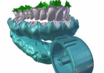 Cepillo de dientes ultrasónicp