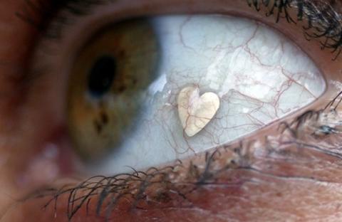 Implante de joyas en ojos