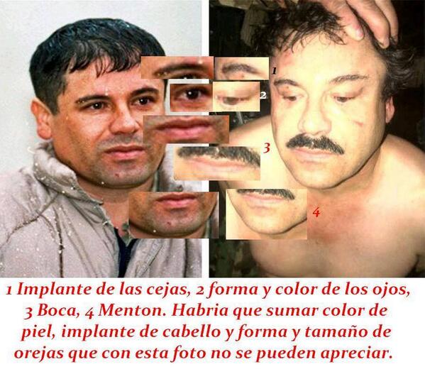 chapo guzman presuntas cirugias
