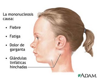 enfermedad del beso