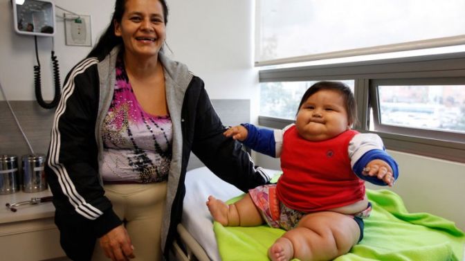 Bebé de ocho meses tiene obesidad mórbida