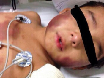Owen niño golpeado en el Estado de México 2
