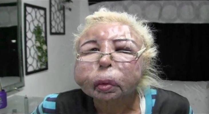 Deformado