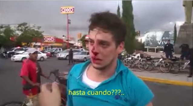 agresión de policías a joven de Aguascalientes 2