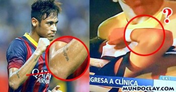 neymar lesión falsa