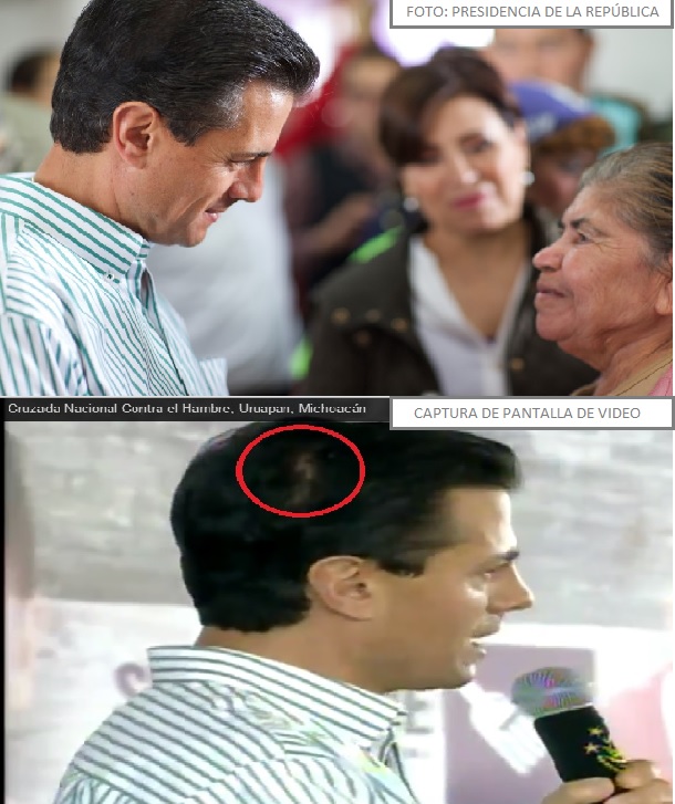 peña nieto alopesia uruapan COMPARATIVO