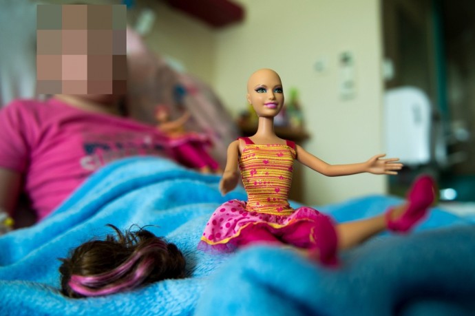 Incrementan Producción De Barbies Calvas En Apoyo A Niñas Con Cáncer