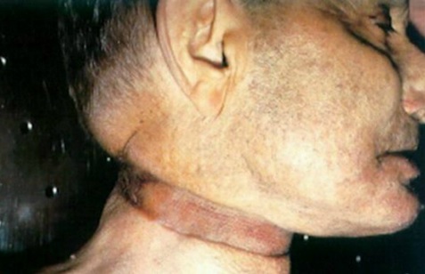 robin williams ahorcado foto