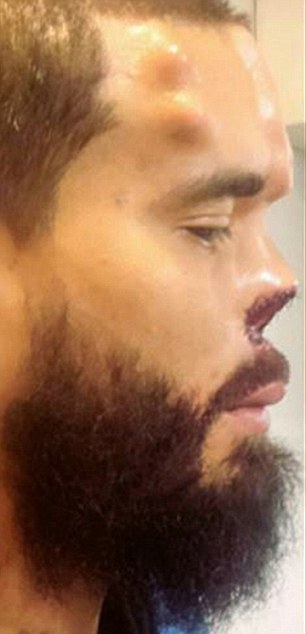 Comic Book Fan Has Nose Chopped Off to Look Like Villain Red Skull