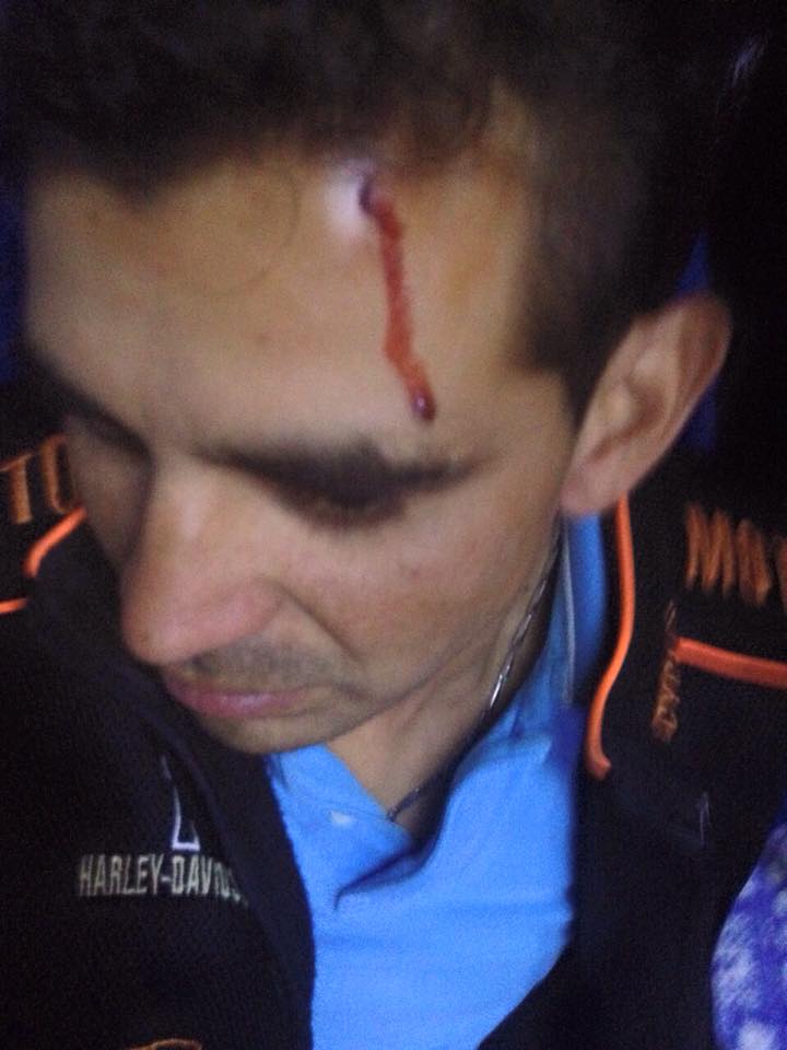 músico agredido Julio Preciado