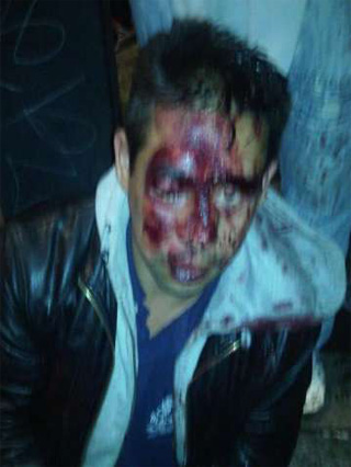 herido-Cuajimalpa-H