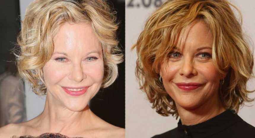 Meg Ryan antes después rostro