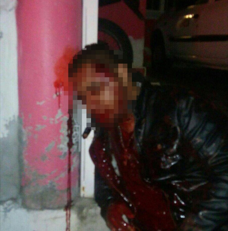 MORELIA Es herido con arma de fuego en la cabeza y vive de milagro (1)