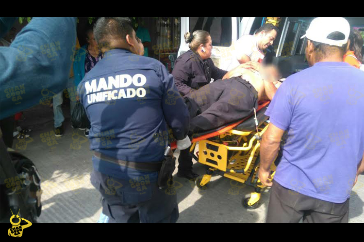 Hombre-Tropieza-Y-Se-Encaja-Un-Cuchillo-En-El-Estómago-2