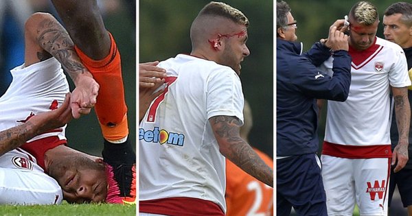 menez 1