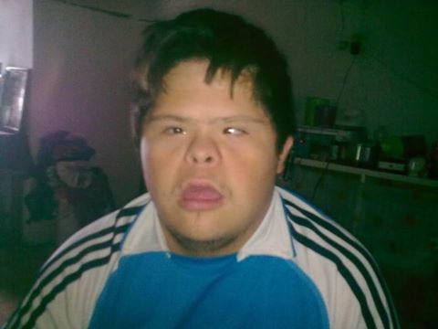 nino-sindrome-de-down