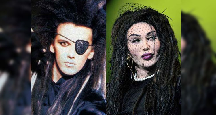 pete-burns-antes-y-despues