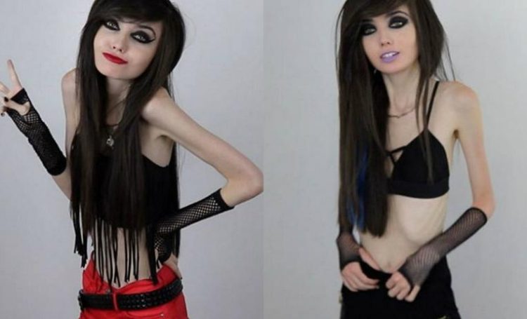 anorexica-youtubber-2