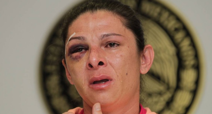 ana-guevara-agresion-2