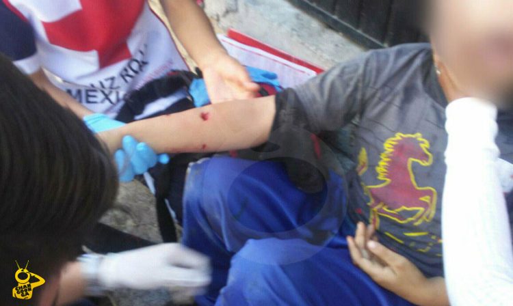 niño-mordido-por-perro