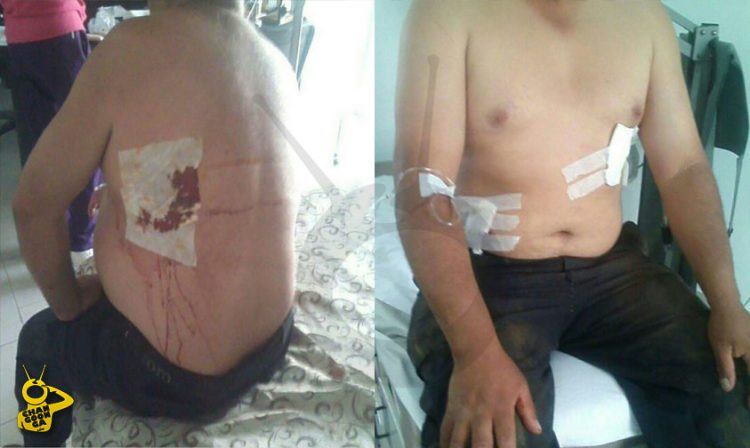 policias heridos tiroteo Zinapecuaro