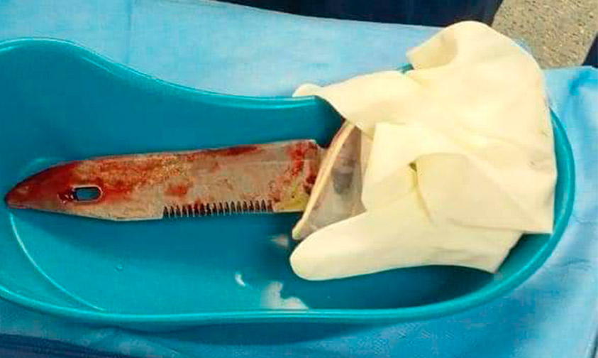 cuchillo-cajón-estacionamiento-Veracruz-a