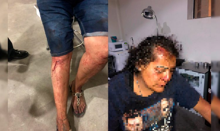 #Morelia Claudia Raquél G. G., fue severamente golpeada por su ex pareja sentimental