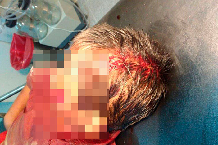 hiere-a-su-hijo-con-machete