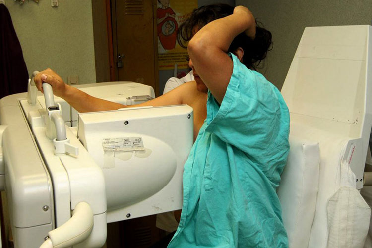 mastografia-cancer-de-mama