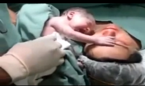Video Bebé recién nacido llora cuando lo separan de su madre