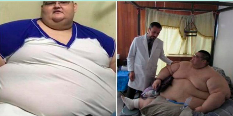 Juan-Pedro-obeso-México-Mundo-cirugía