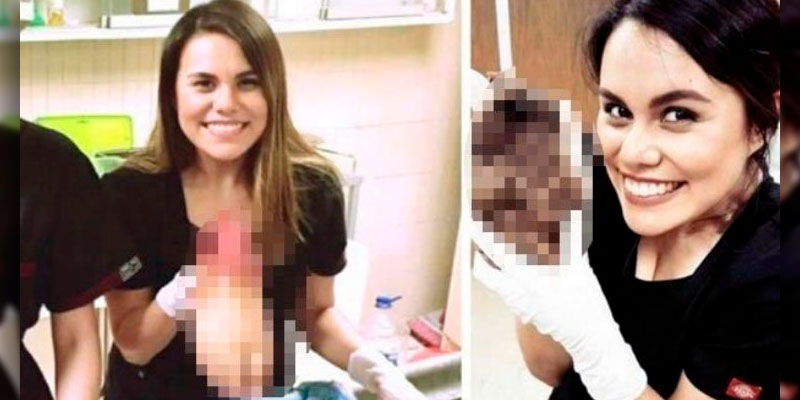 residentes-IMSS-pierna-amputada-estomago