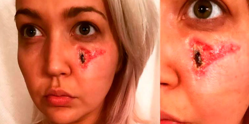 Meghan-Linsey-araña