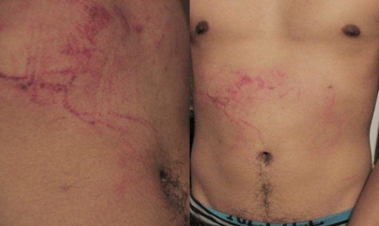 agresion-chavo-gay-Morelia
