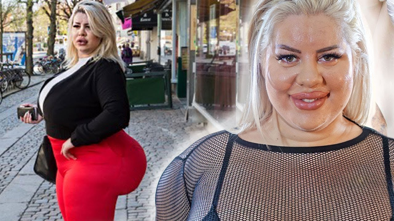 WTF! Esta Mujer Quiere Tener El Trasero Más Grande Del Mundo