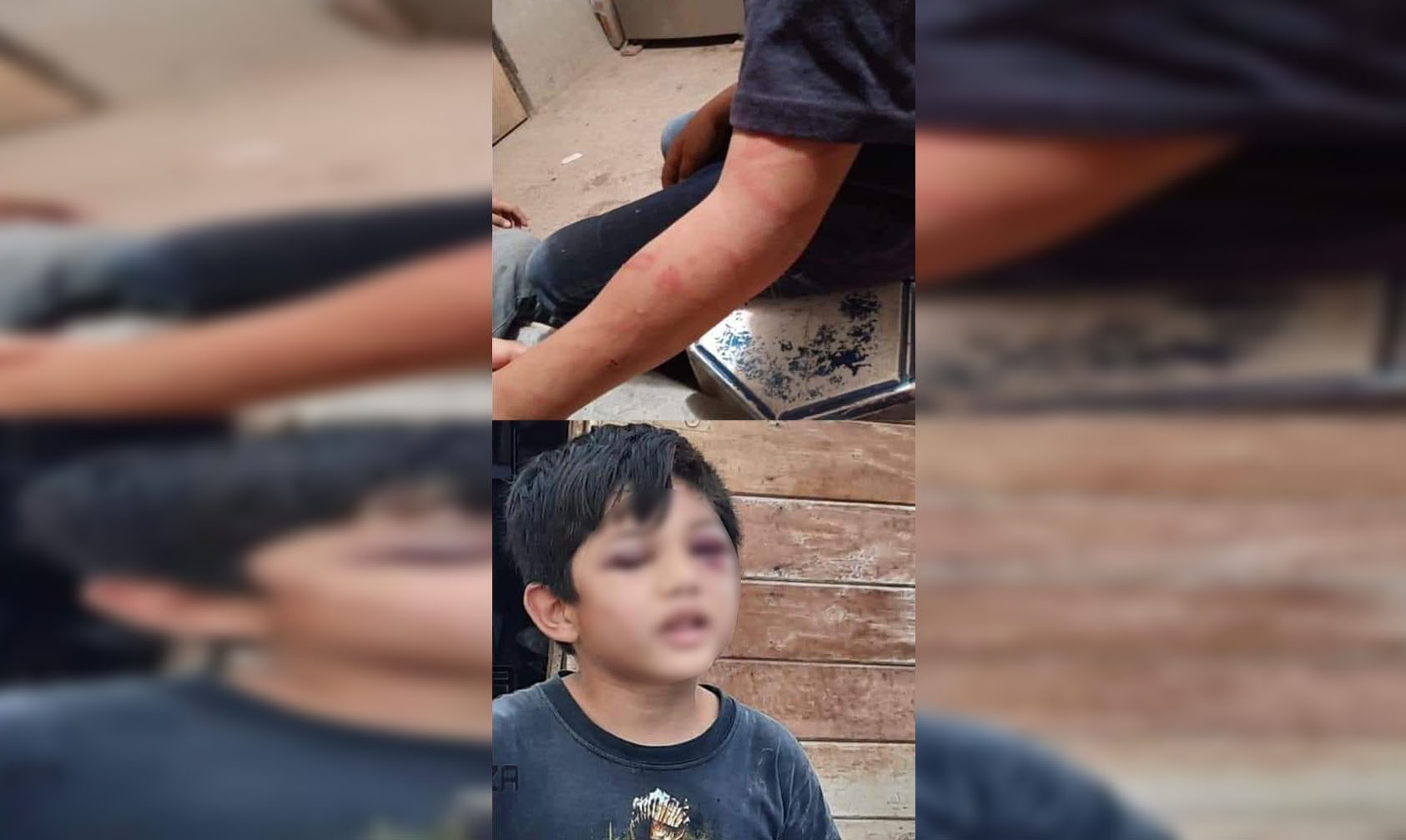 Que Observar Cuando Un Niño Se Golpea La Cabeza